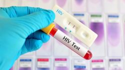Waspada! Tertular HIV Akibat Jalani Treatment ‘Vampire Facial’