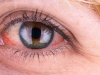 Ada 3 Cara Menjaga Kesehatan Mata Bagi Pengguna Kontak Lensa