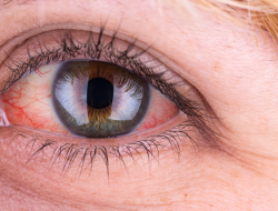 Ada 3 Cara Menjaga Kesehatan Mata Bagi Pengguna Kontak Lensa