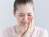 4 Bahan Alami untuk Mengatasi Sakit Gigi, Salah Satunya Kunyit