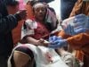 Detonator Granat Meledak di Kebun, Petani di  Tinggimoncong Kehilangan Tiga Jari Tangan